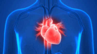 Preventing Coronary Plaque Formation: A Guide to Reducing Heart Disease Risk